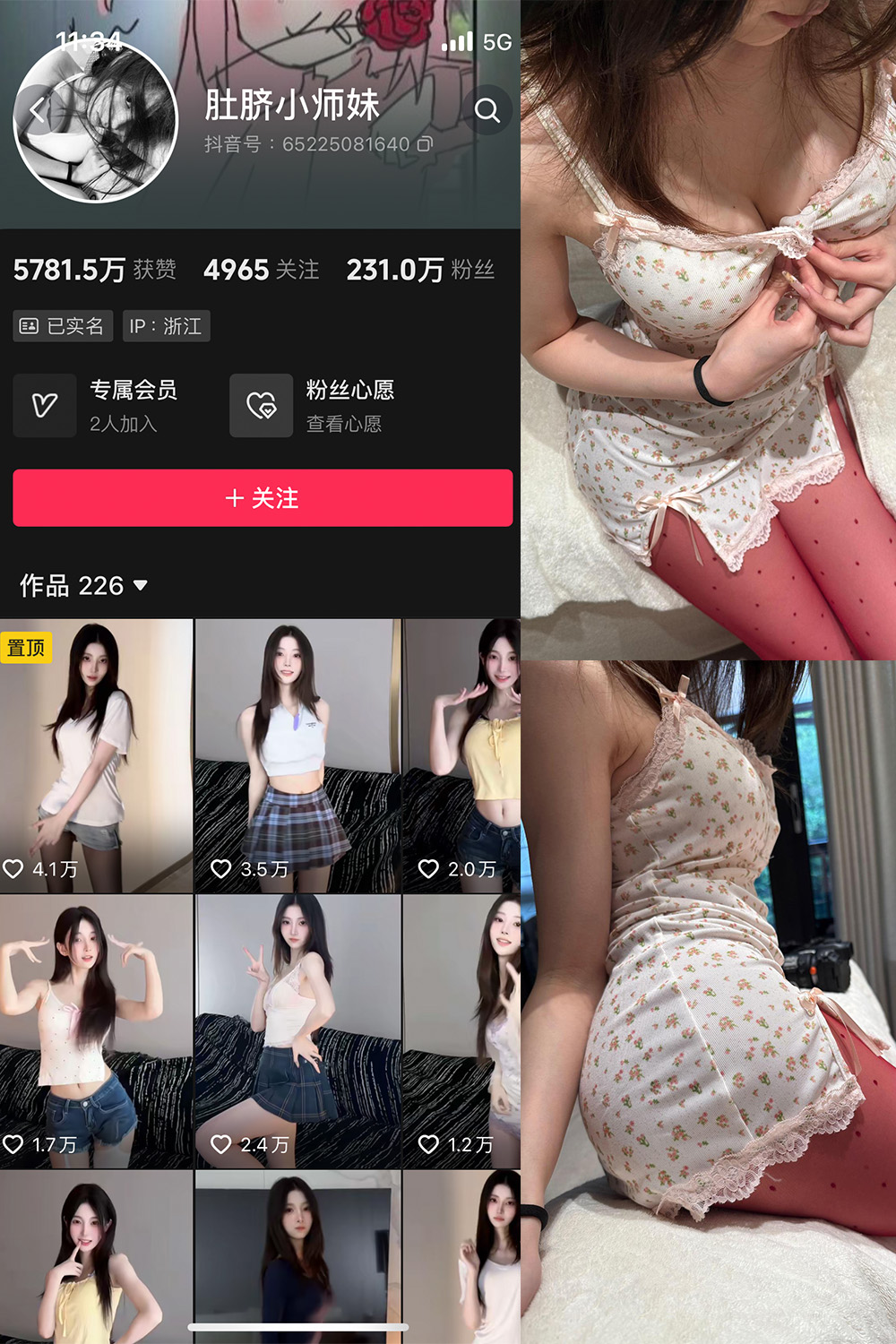 抖音 肚脐小师妹 微密圈  NO.037期 【15P2V】最新至：2025.4.13